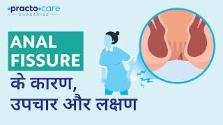 Anal Fissure: Causes & Symptoms | What is Anal Fissure (In Hindi) | Practo