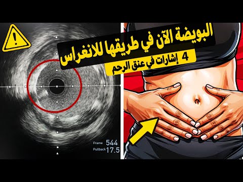 كيف يكشف لك عنق الرحم أن مرحلة التلقيح انتهت الآن وأن الانغراس على وشك الحدوث