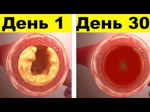 Видео: Как очистить кровь: детоксикация, вирусы, токсины, чай