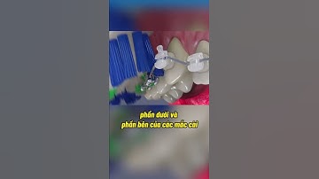 #100 Cách vệ sinh răng miệng khi niềng đúng cách không phải đồng niềng nào cũng biết! #nhakhoaledong