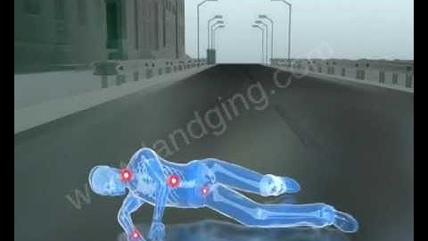 Accident Animation: Slip and Fall