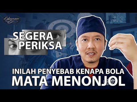 Video: Adakah blepharoplasty diperlukan dari segi perubatan?