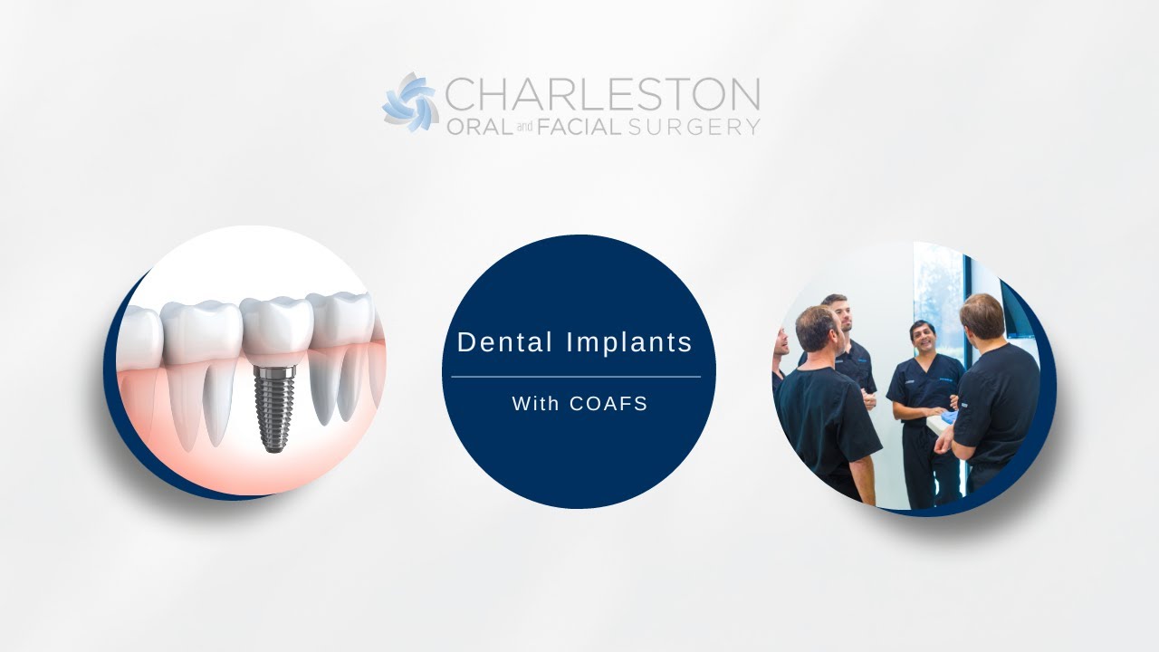 Dental Implants - YouTube