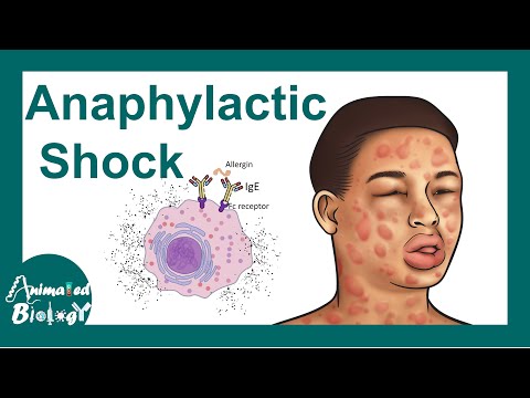 Videó: Hogyan kezeli az anafilaxiás reakciót?