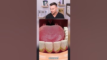 What Happens If You DON’T Brush Your Teeth For A YEAR! 😮🦷