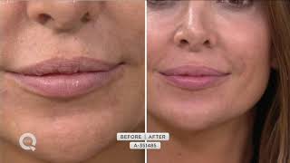 Crepe Erase Flaw-Fix Crepey Lip Treatment Duo Auto-Delivery on QVC