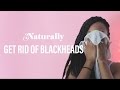 GET RID OF BLACKHEADS NATURALLY