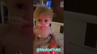 Meet a beautiful Critical care unit baby 🥰 #medicalyukti #nicucare