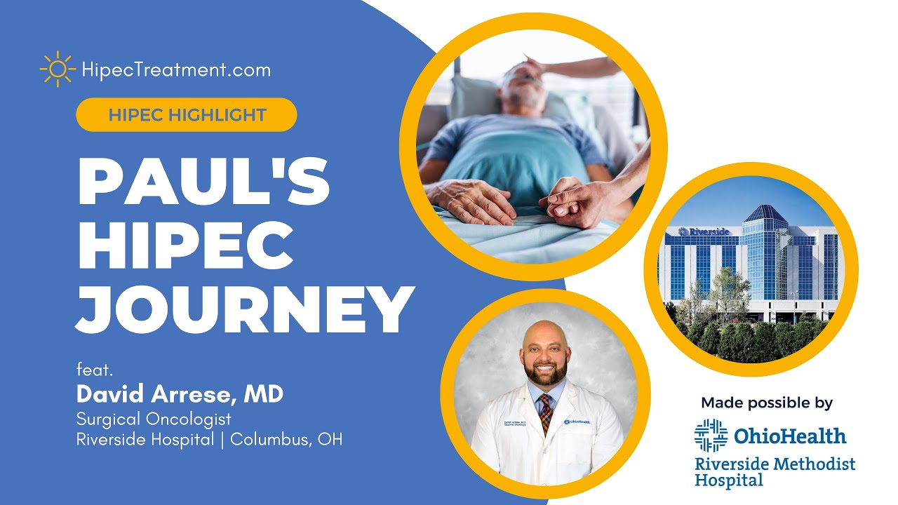 Abdominal Cancer vs. HIPEC | Paul's Story | feat. Dr. David Arrese | HipecTreatment.com