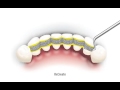 Полиарамидная лента Dental Life Science. Lamyra