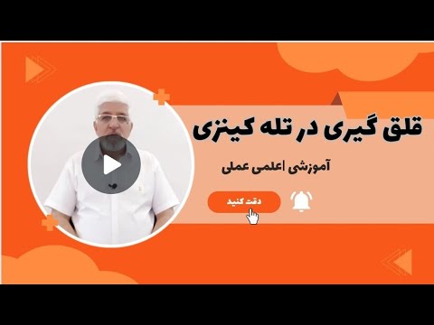 قلق گیری در تله کینزی چگونه تله کینزی را برای ذهن باور پذیر کنیم
