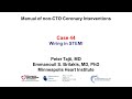 Case 44: Manual of non-CTO coronary interventions - wiring in STEMI