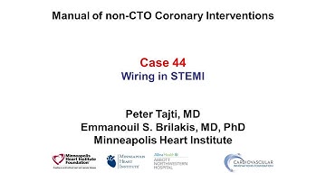 Case 44: PCI Manual - Wiring in STEMI