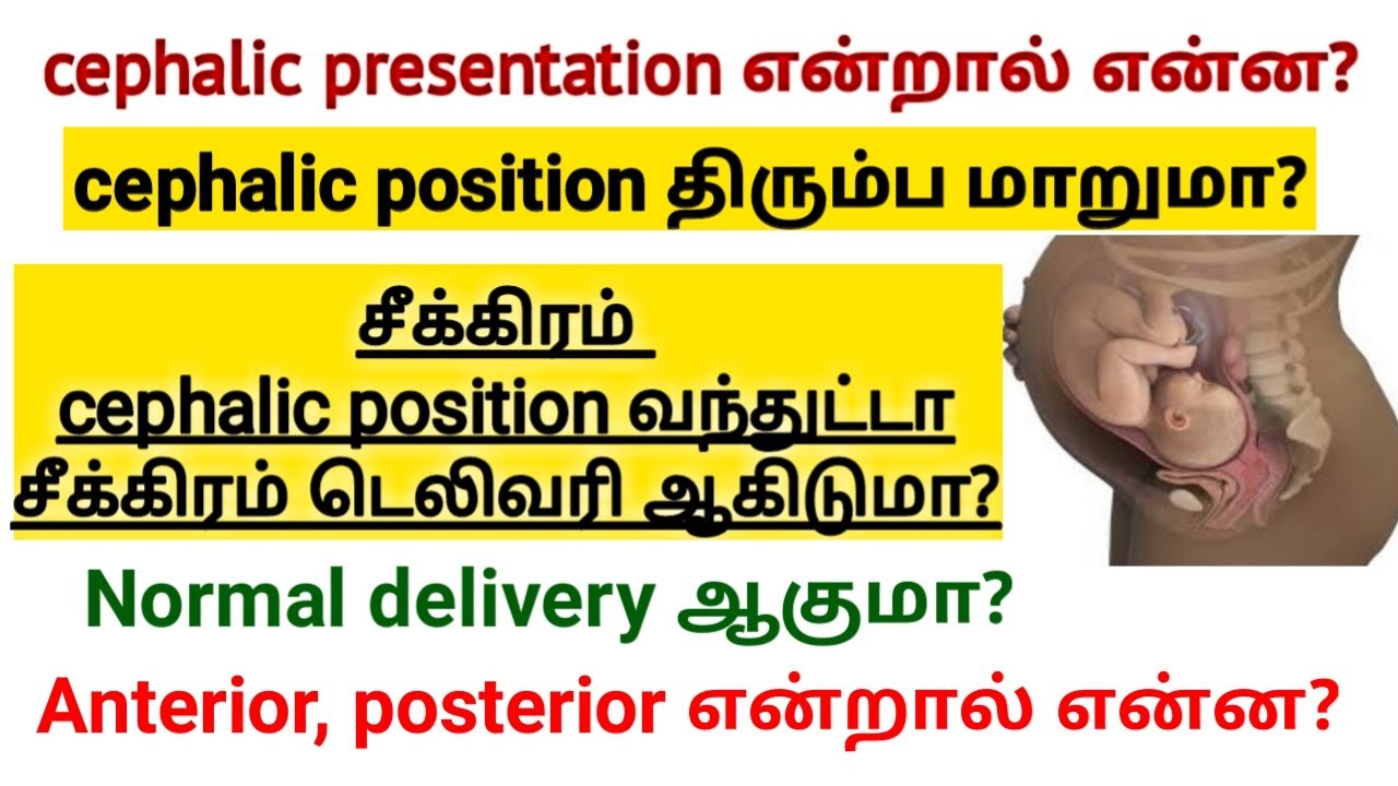 cephalic presentation symptoms in tamil