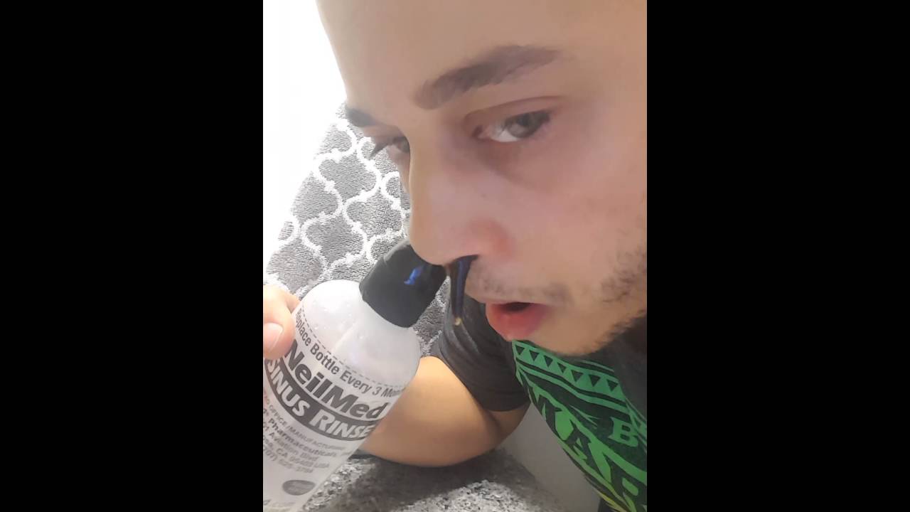 Sinus Surgery Aftermath YouTube