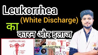 White Discharge in womenLeukorrhea Treatment#whitedischarge@LokmatSakhi#viralvideo @riyamalhotra