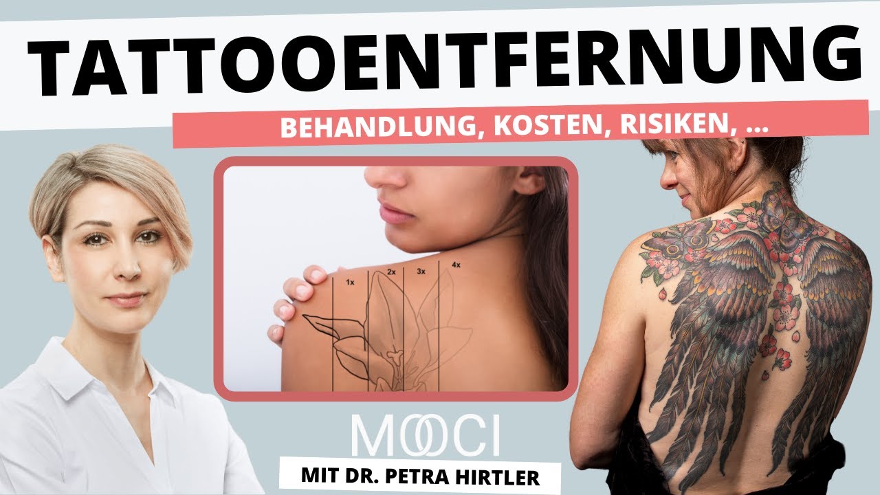 Faqs Zu Tattooentfernung Und Asthetik Dr Petra Hirtler