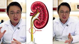 Dapagliflozin and genital infection: why it happens and how to prevent it