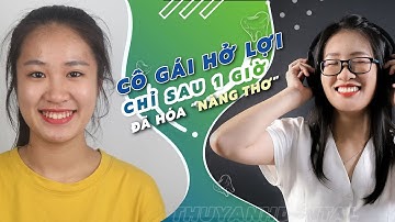 Kết Quả Phẫu Thuật Cười Hở Lợi Như Thế Này Đã Đủ Làm Bạn Ấn Tượng Chưa?