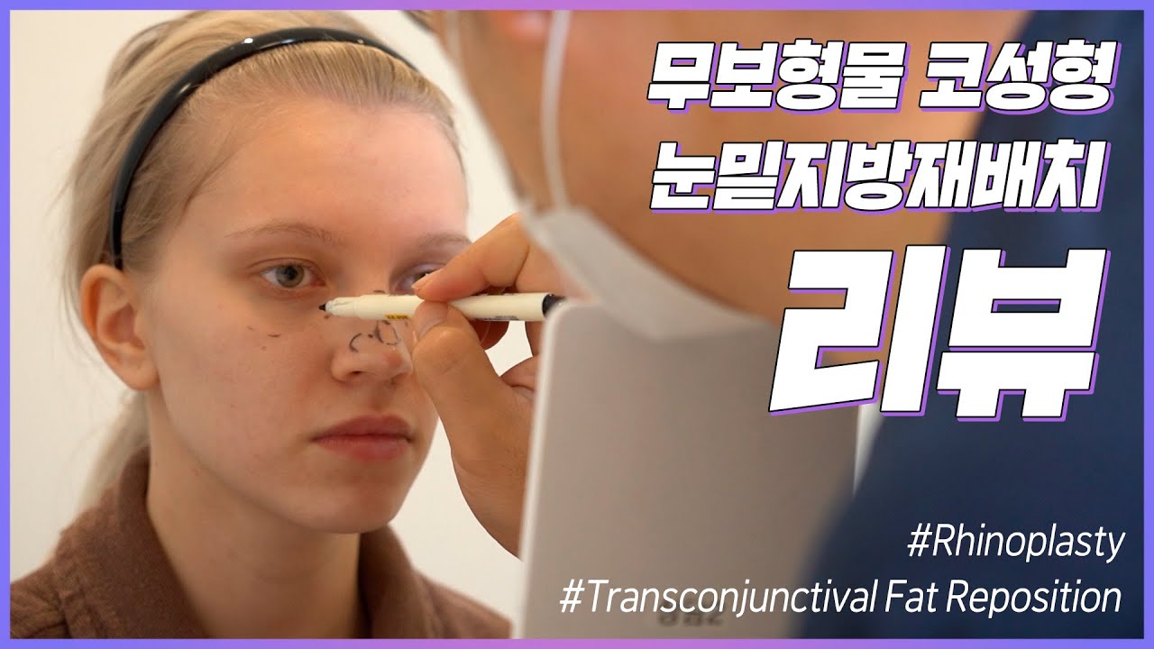 [ЭЙТОП Хуванцар мэс засал] [KOR/ENG Хадмал] Онцгой ялгаатай! 👀Нүдний доорх өөх шилжүүлэн суулгах+👃имплантгүй хамарны мэс засал хийлгэлээ/Зузаннагийн гоо сайхны мэс заслын бодит түүх(Оролцсон: Захирал И Хан Жон)