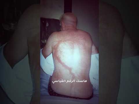 هل ممكن البرق يصيبك او يصيب نفس المكان مرتين