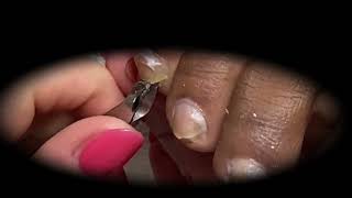 Ingrown Toenails Treatment Satisfying Pedicure Manicure #12
