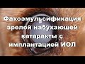 Факоэмульсификация зрелой набухающей катаракты у собаки с имплантацией ИОЛ