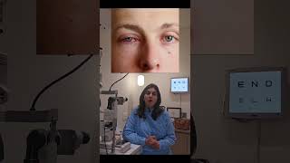 Dry Eye Allergic eye??what to do???