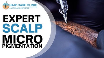 WHAT Is SCALP MICROPIGMENTATION ? Everything YOU Need to Know About SMP | AM Hair Care