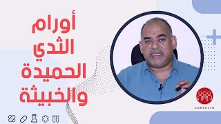 الفرق بين الورم الحميد والخبيث فى أورام الثدى