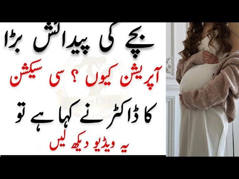 C -Section Delivery l  Cesarean Section In Urdu  l  بچے کی پیدائش کے لیے آپریشن