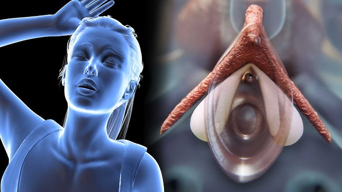 Xotinimning teshiklari fotosurati Kondiloma akuminatum bilan jinsiy aloqada bolish