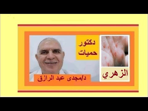مرض الزهري وألام العضلات Syphilis And Muscle Pain 
