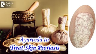 Ayurvedic Treatment for managing Skin Psoriasis | PSORIASIS - Dr. Chaithanya K S | Doctors' Circle
