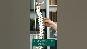 3 причины боли в спине. Почему болит позвоночник #Shorts