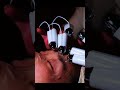 E-3 Finger Focus: Tighten & lift instantly #sanfransico #faical #skincare #sf