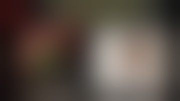 Right Hepatectomy with Caudate Lobectomy for Hilar Cholangiocarcinoma | Dr Hitesh Chavda