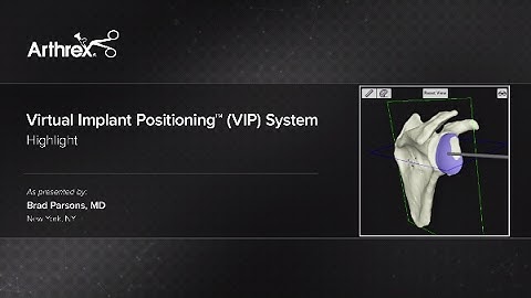 Virtual Implant Positioning™ (VIP) System Presentation
