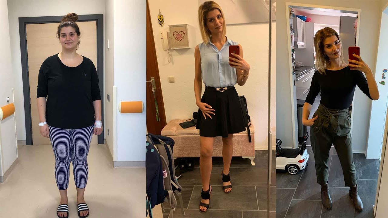 Obezite Cerrahisi Sonrası - Tufan Ergenç Süper!