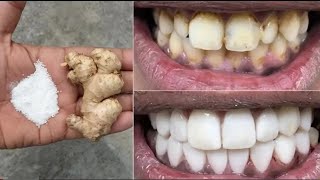 Die schnellsten und sichersten Methoden um Zähne natürlich aufzuhellen!