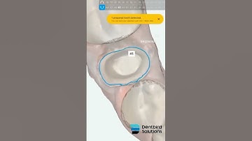 Online AI Dental Crown Design