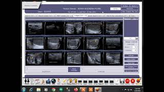 DICOM MODULE of DiagnoFlame Software