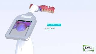 Digital Shade Scanner - RAY PLICKER HANDY Easy Shade screenshot 4