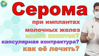 Серома при имплантах молочных желез | Капсулярная контрактура.