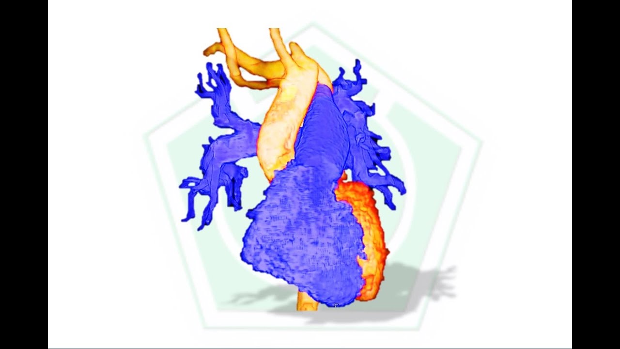 health industry cybersecurity practices Persistencia del Conducto Arterioso - PCA