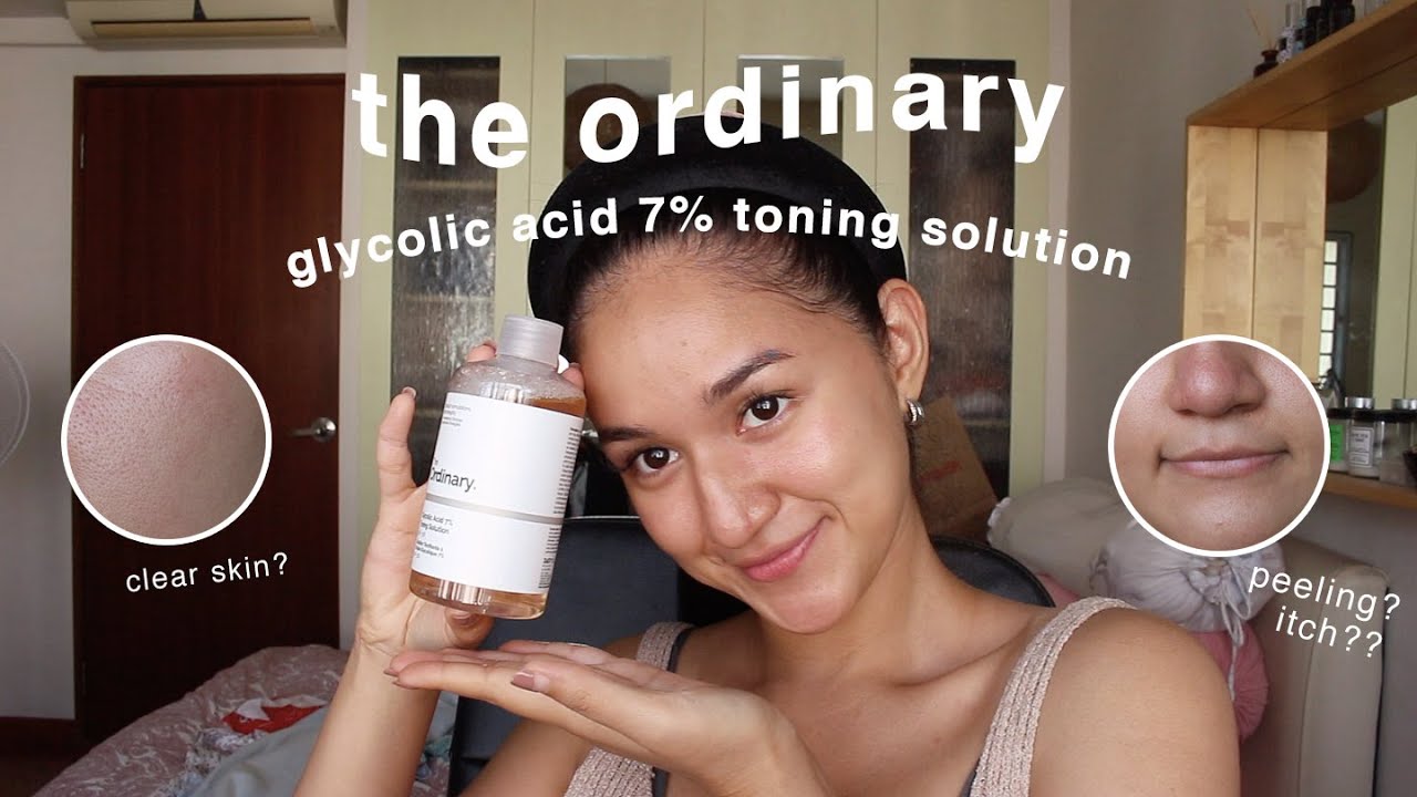 the ordinary glycolic acid toner 1 MONTH review (w BEFORE/AFTER)