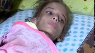 بالفيديو طفلة بريئة تتعرض للتعذيب والضرب بالمطرقة من قبل والدتها في بغداد