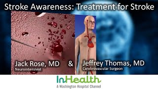 Famous Stroke Awareness - Treatment for Stroke Profile