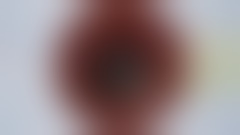 Single Pass Four Throw Pupilloplasty - Step by Step with Audio