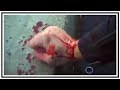 Bleeding Police Officer Hit With Handcuffs During Arrest | Body Cam | United States | 20190216